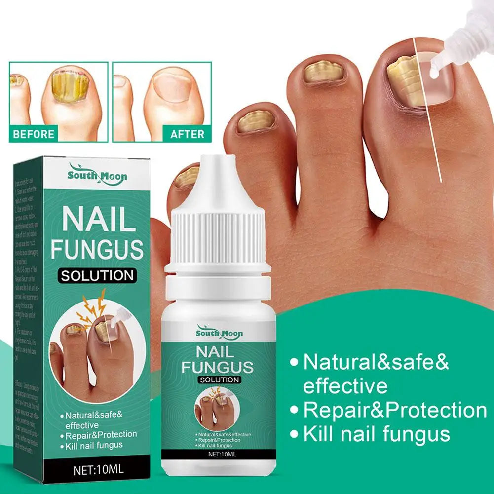 Sérum Anti-Fongique pour Ongles 10ml – Traitement Onychomycose & Paronychie