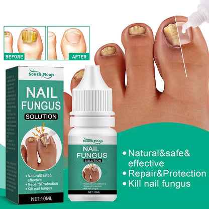 Sérum Anti-Fongique pour Ongles 10ml – Traitement Onychomycose & Paronychie