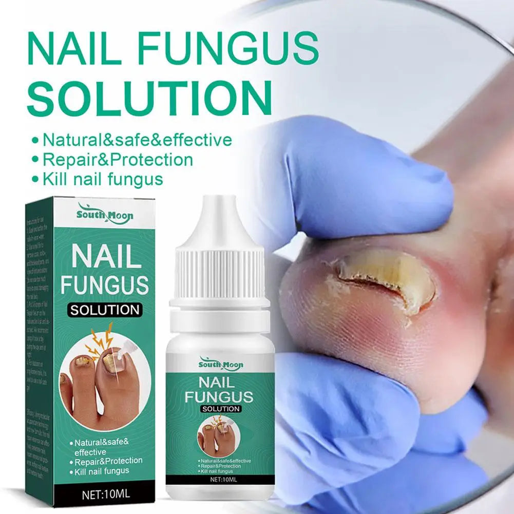 Sérum Anti-Fongique pour Ongles 10ml – Traitement Onychomycose & Paronychie