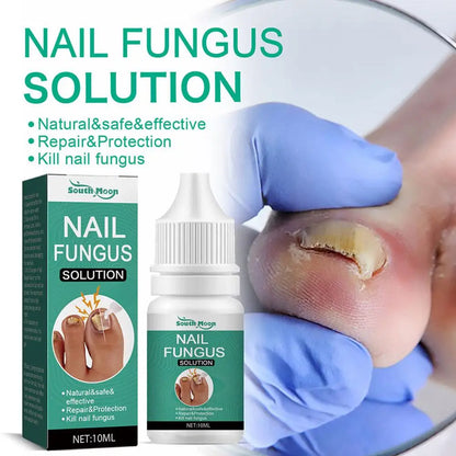 Sérum Anti-Fongique pour Ongles 10ml – Traitement Onychomycose & Paronychie