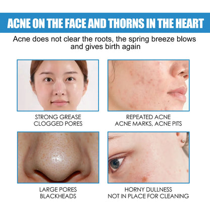 Crème Réparatrice Centella Asiatica 40ml - Hydratante Métabolisme Éclaircissante Resserre Pores Anti-Acné