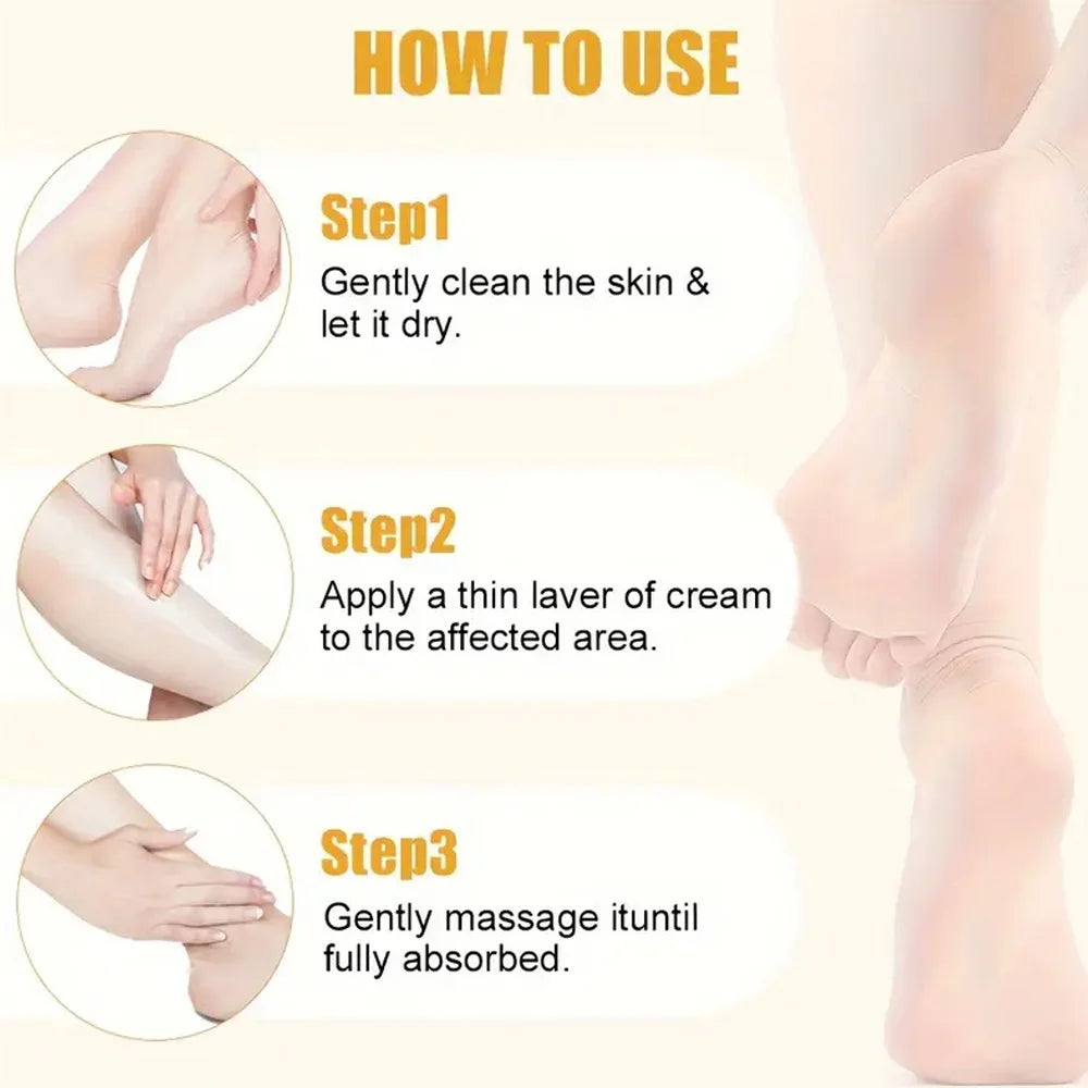 Crème Urée 40% Pieds 40g - Talons Fissurés Genoux Mains Hydratante Réparatrice Exfoliante Peau Sèche