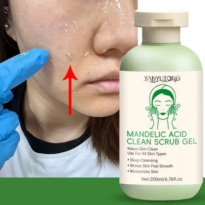 Gel Exfoliant Visage Aloe Vera - Nettoyage Profond Pores Hydratant Éclaircissant Réparateur