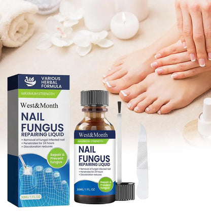 Sérum Réparateur Ongles 7 Jours – Anti-Fongique, Onychomycose & Ongles Incarnés