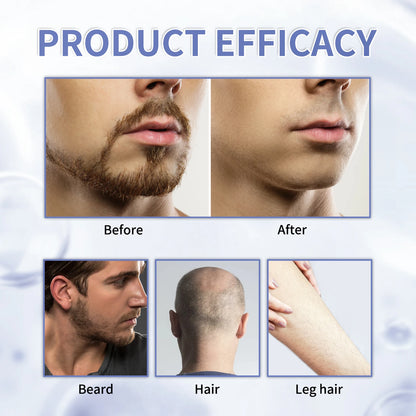 Crème à Raser Protect 100ml - Formule Douce Hydratante Peau Sensible Réduit Irritations Mousse Riche Rasage