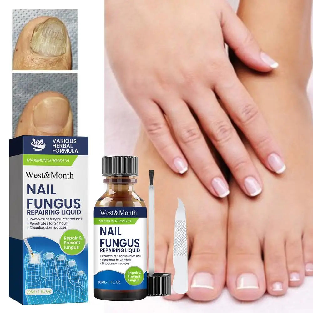 Sérum Réparateur Ongles 7 Jours – Anti-Fongique, Onychomycose & Ongles Incarnés
