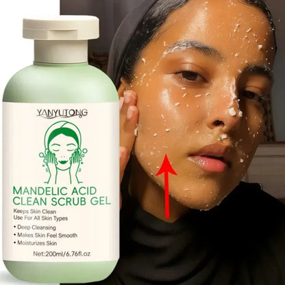Gel Exfoliant Visage Aloe Vera - Nettoyage Profond Pores Hydratant Éclaircissant Réparateur