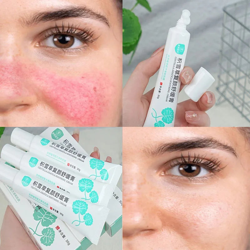 Crème Réparatrice Rougeurs Visage 5pcs - Rosacée Acné Peau Sensible Sèche Hydratante Apaisante K-Beauty