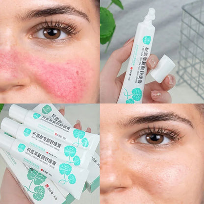 Crème Réparatrice Rougeurs Visage 5pcs - Rosacée Acné Peau Sensible Sèche Hydratante Apaisante K-Beauty