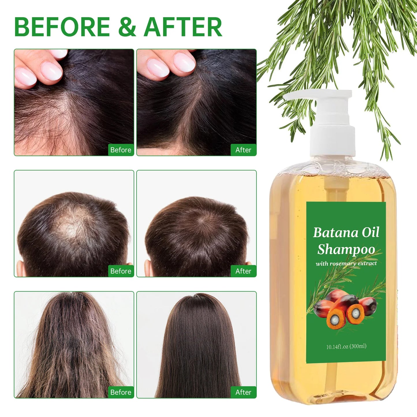 Shampooing Croissance Batana Oil & Romarin 300ml - Anti-Frisottis Anti-Casse
