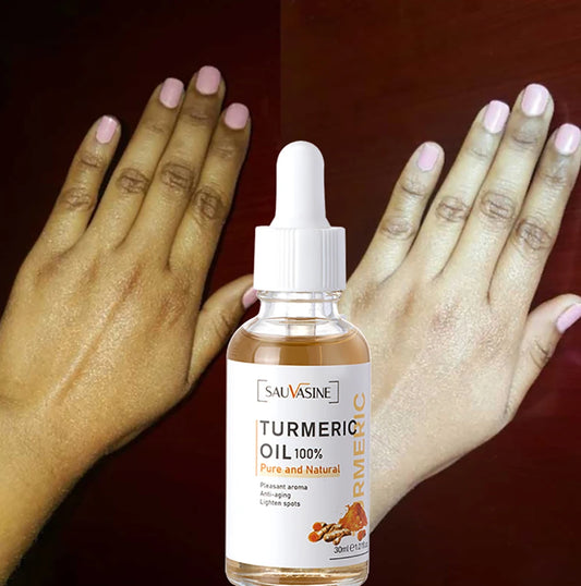 Huile Curcuma 100% Pure 10ml - Sérum Anti-Âge Rides Éclaircissant Taches Brunes Ridules Visage Femme