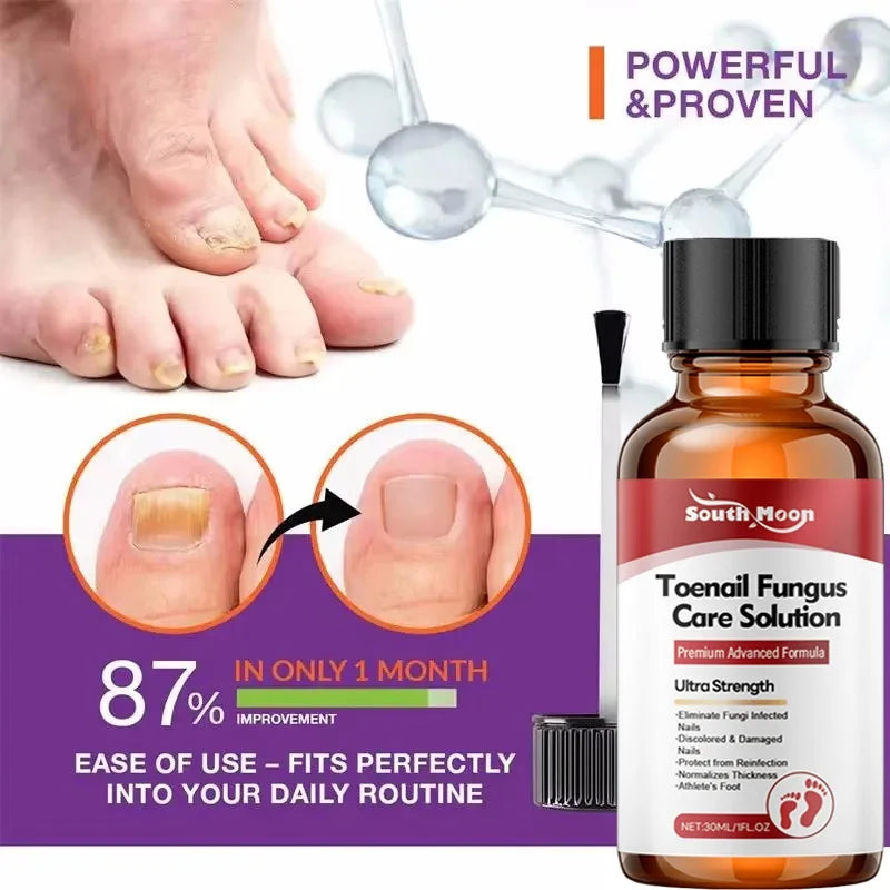 Sérum Traitement Antifongique pour Ongles – Huile Réparatrice Anti-Infection
