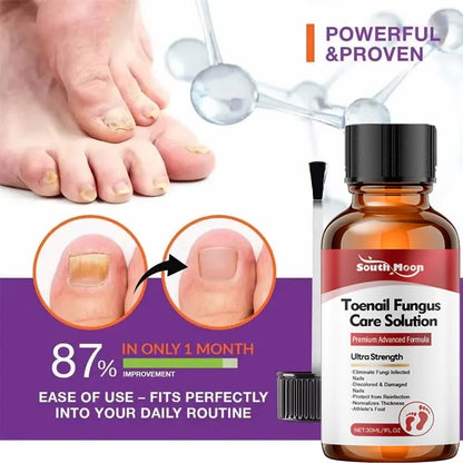 Sérum Traitement Antifongique pour Ongles – Huile Réparatrice Anti-Infection