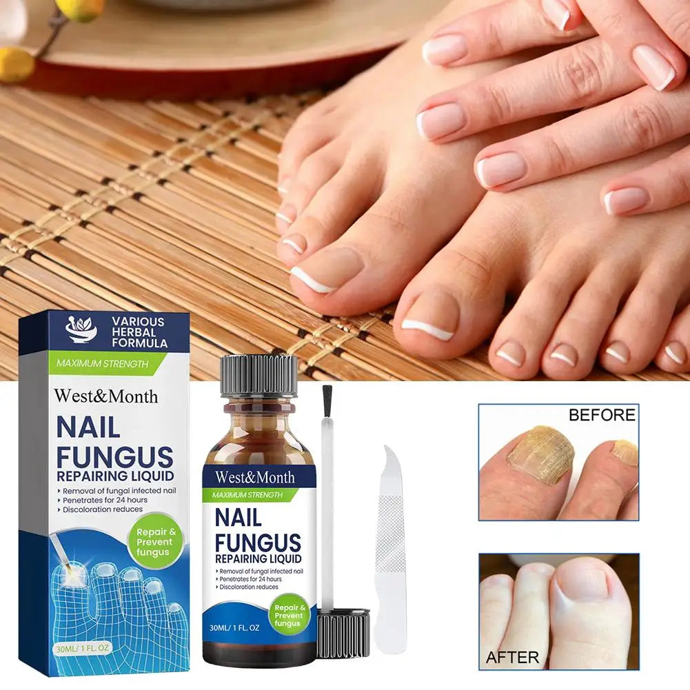 Sérum Réparateur Ongles 7 Jours – Anti-Fongique, Onychomycose & Ongles Incarnés