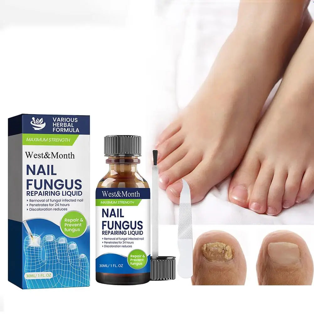 Sérum Réparateur Ongles 7 Jours – Anti-Fongique, Onychomycose & Ongles Incarnés