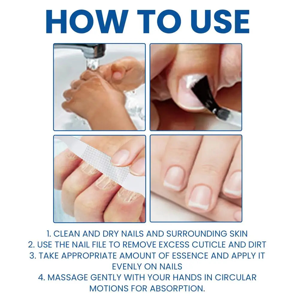 Sérum Réparateur Ongles 7 Jours – Anti-Fongique, Onychomycose & Ongles Incarnés