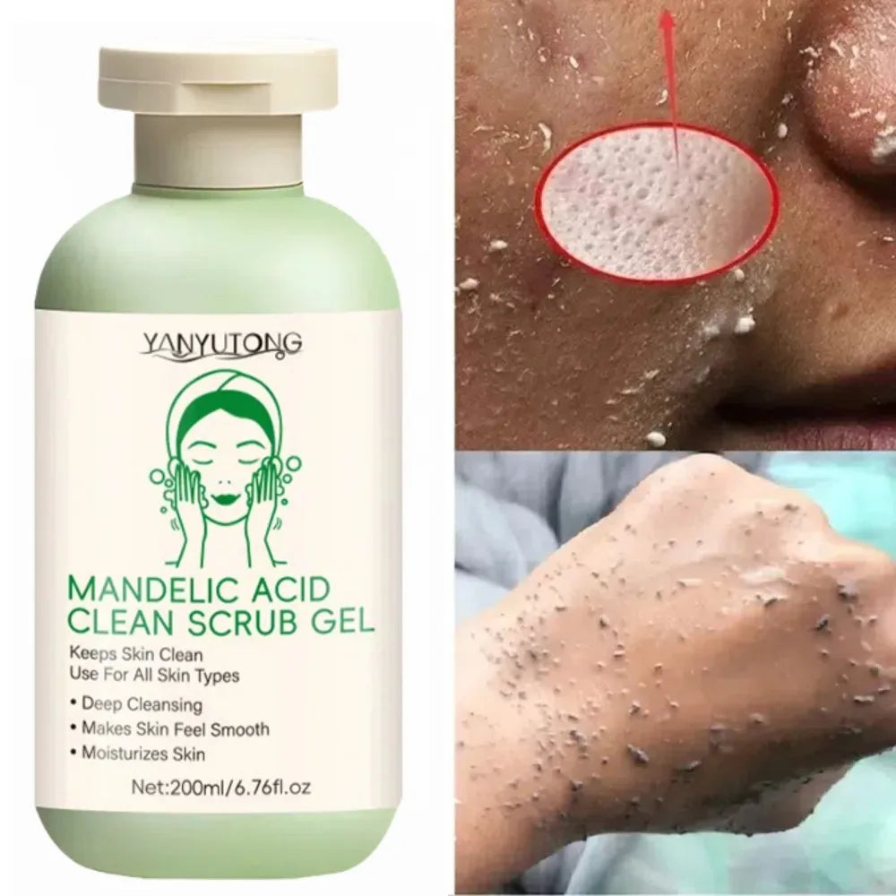 Gel Exfoliant Visage Aloe Vera - Nettoyage Profond Pores Hydratant Éclaircissant Réparateur