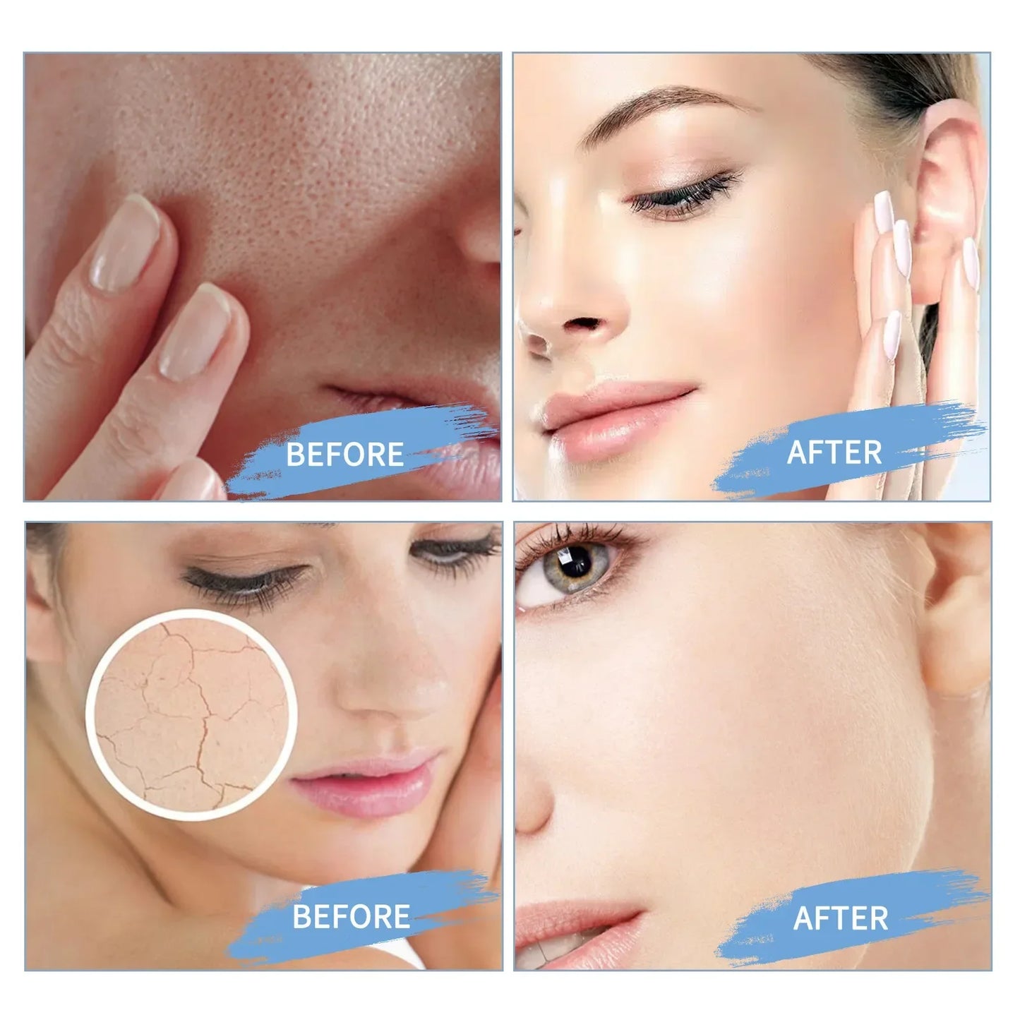 Crème Apaisante 345 - Rajeunissement Réduction Rougeurs Hydratante Anti-Âge Soin Visage Beauté