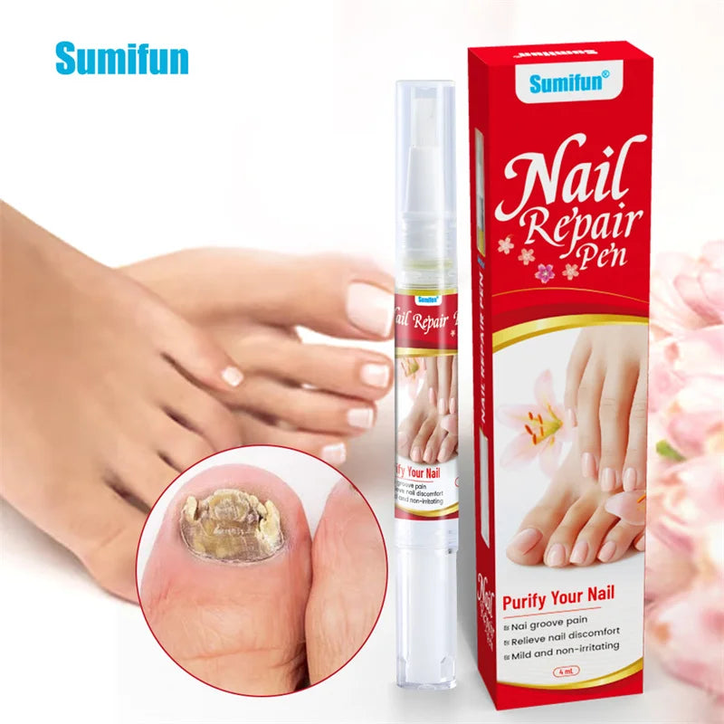Sérum Traitement Antifongique pour Ongles – Huile Réparatrice Anti-Infection