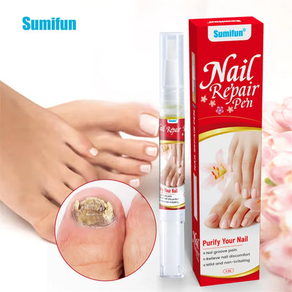 Sérum Traitement Antifongique pour Ongles – Huile Réparatrice Anti-Infection