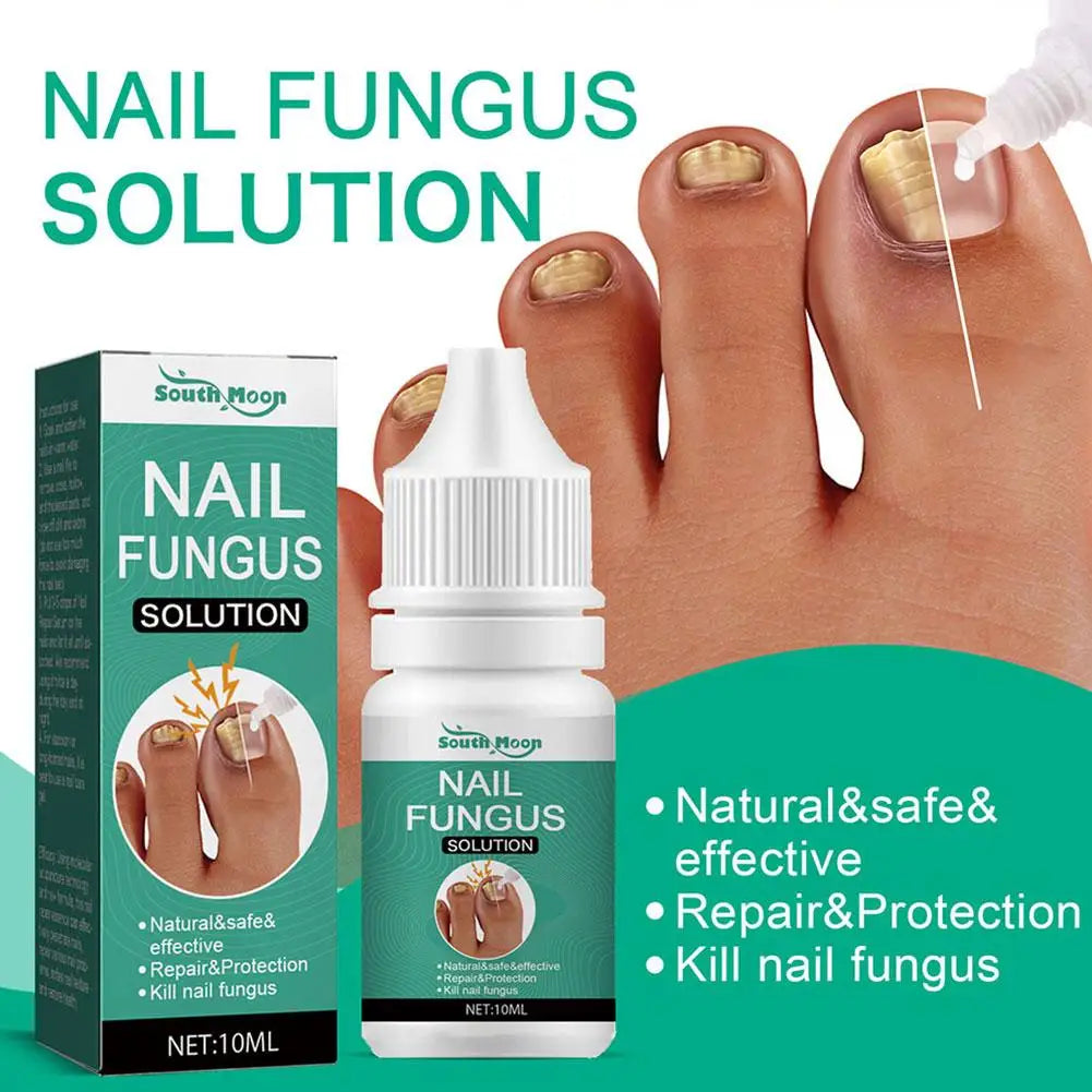 Sérum Anti-Fongique pour Ongles 10ml – Traitement Onychomycose & Paronychie