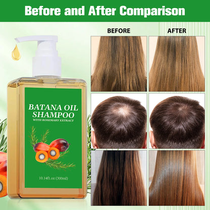 Ensemble Shampooing & Huile de Batana Pure - Croissance & Réparation Capillaire
