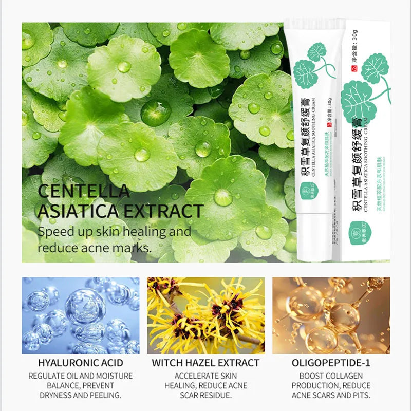 Crème Réparatrice Rougeurs Visage 5pcs - Rosacée Acné Peau Sensible Sèche Hydratante Apaisante K-Beauty