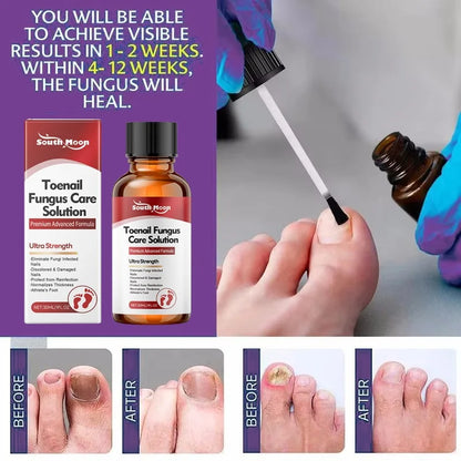 Sérum Traitement Antifongique pour Ongles – Huile Réparatrice Anti-Infection